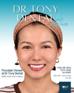 Dr Tony Dental - Veneer and Invisalign Center