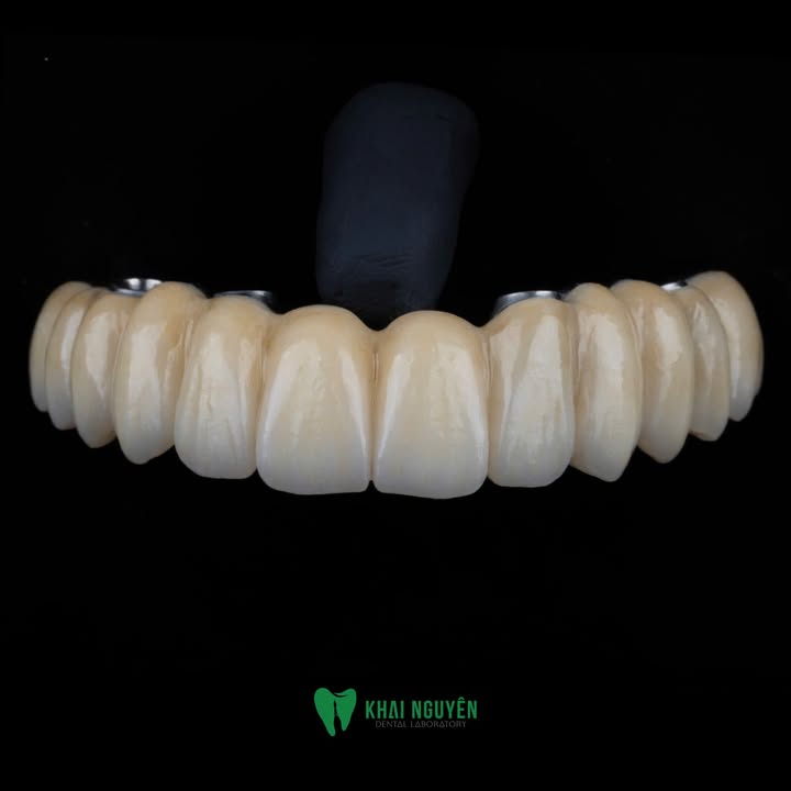 Phục hình All-on-4 FP1 trên phôi zirconia màu A2