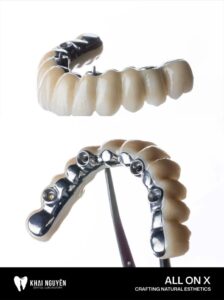 Phục hình All-on-4 FP1 trên phôi zirconia màu A2