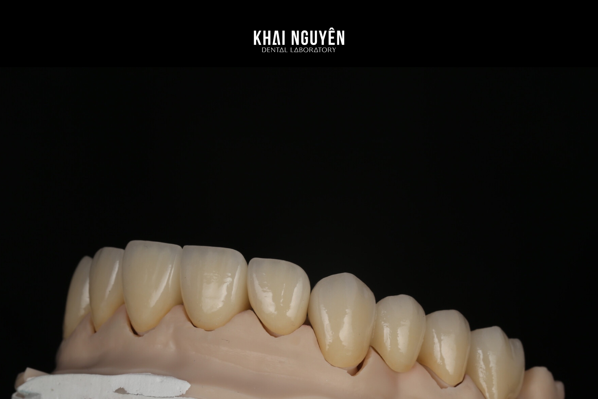 Twelve-unit zirconia restoration, right lateral view
