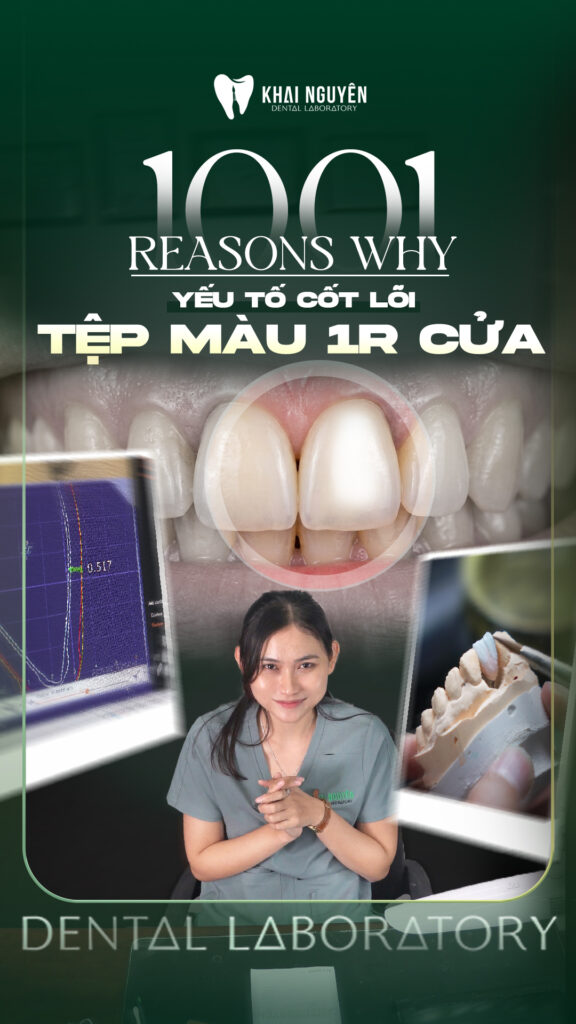 Phục hình một răng cửa trên nền cùi tối: ba yếu tố bác sĩ cần chuẩn bị, Khai Nguyên Dental Lab