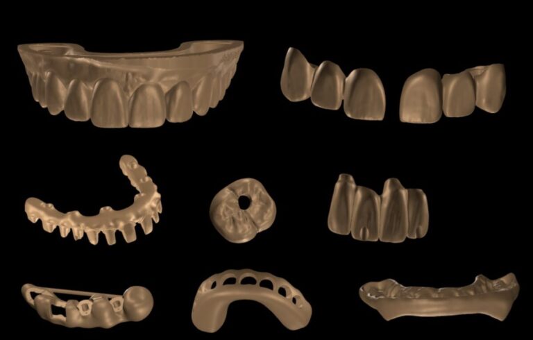 CAD designs by Khai Nguyen: wax-ups, crowns, bridges, abutments, All-on-X framework, splints
