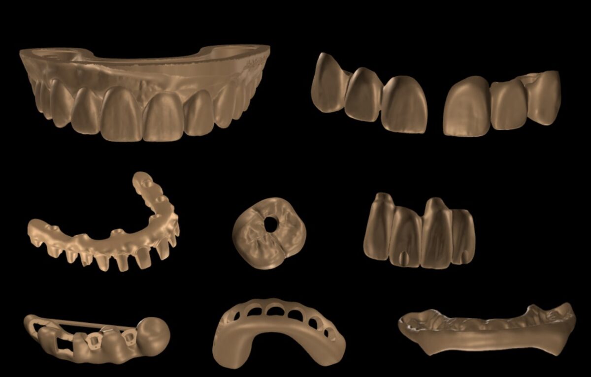 Các bản thiết kế CAD của Khai Nguyên: wax-up, mão, cầu, abutment, khung All-on-X, máng