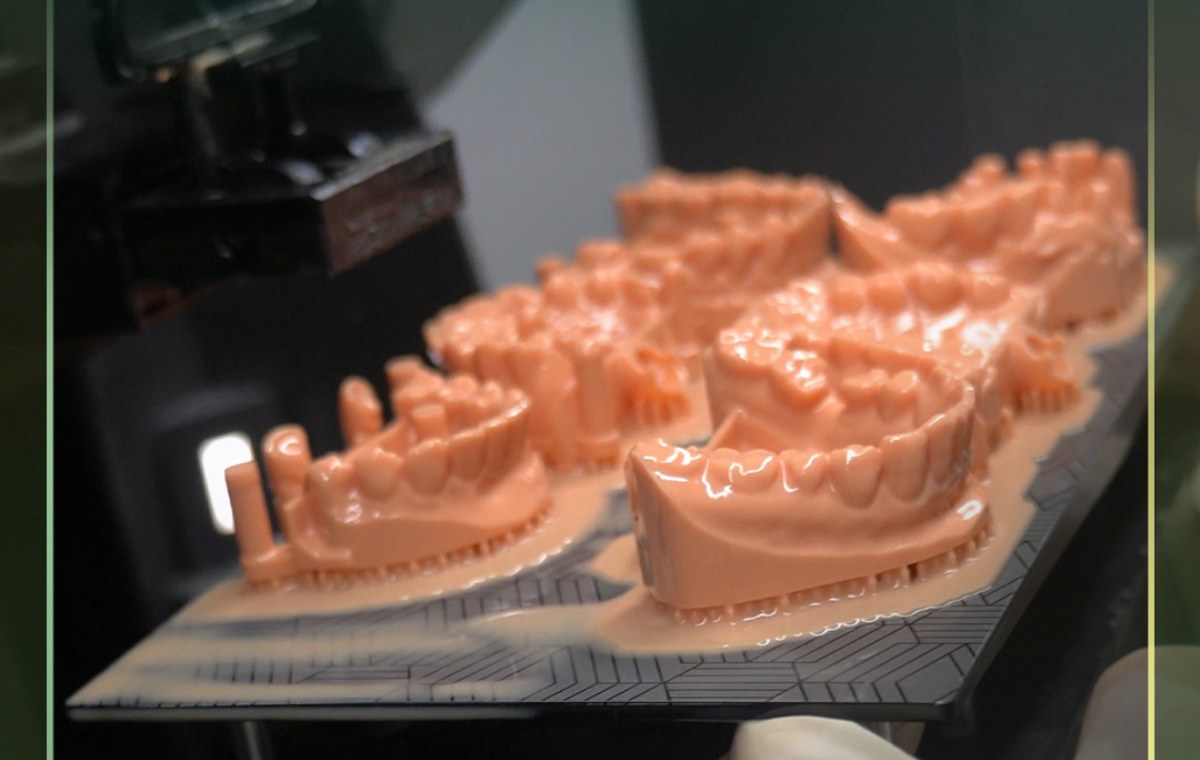 Freshly 3D-printed dental models on the build plate in the printing room at Khai Nguyen Dental Lab