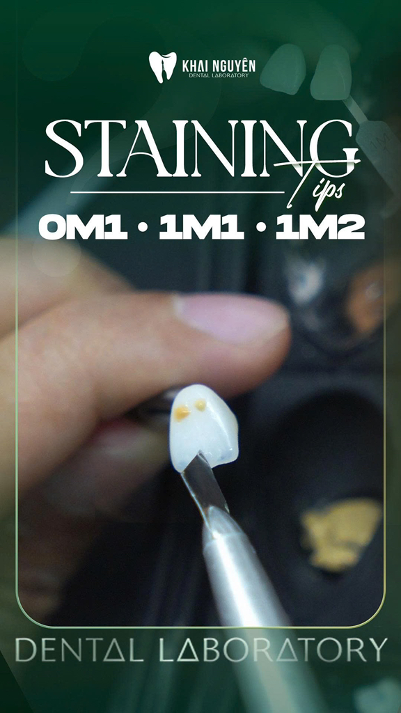 Kỹ thuật stain trên phục hình sứ: thay đổi tỉ lệ màu để đạt các tông 0M2, 1M1, 1M2