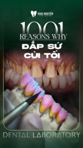 Series 1001 câu hỏi vì sao tại labo, tập 2: bí kíp xử lý ca cùi tối màu, đắp sứ trên sườn