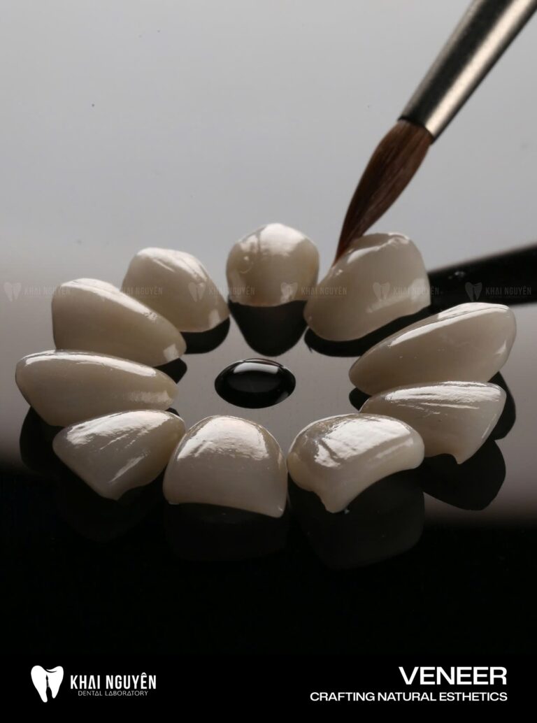 Ten IPS e.max Press veneers arranged on a glass plate with a stain brush, Khai Nguyen Dental Lab